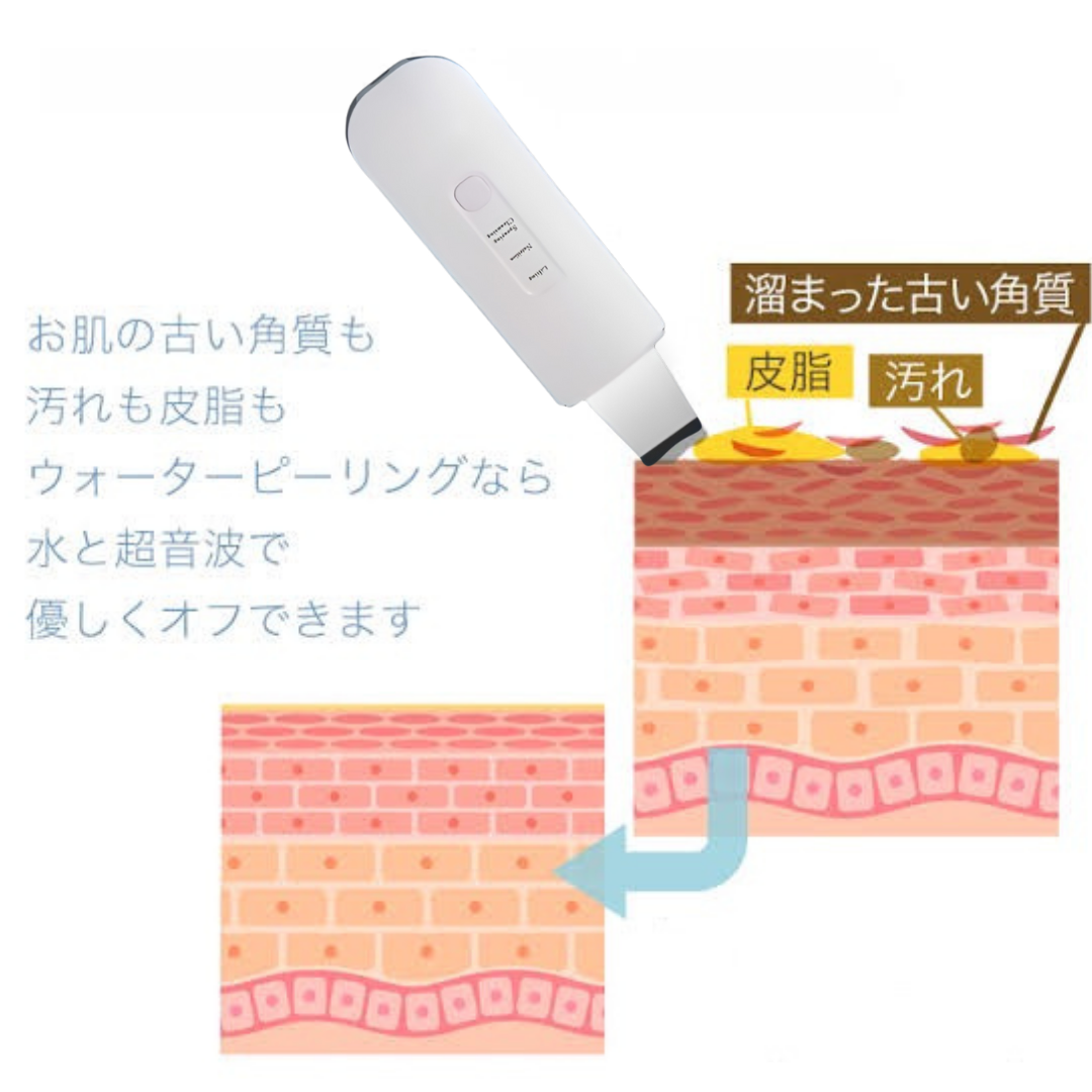 洗顔の常識を覆した美顔器「Ultrasound Spray Skin Scrubber」1