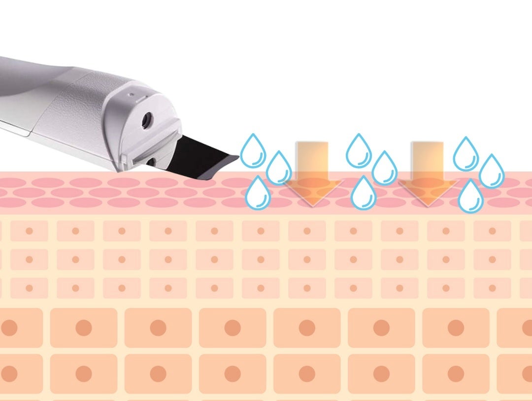 Derma Scraber 美顔器　毛穴の汚れ　浸透 Derma Scraber 美顔器 毛穴の汚れ 浸透 楽天市場】【楽天1位受賞