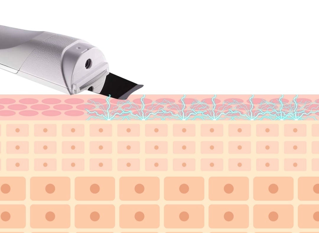 Skin Beauty Device 美顔器 洗顔の常識を覆した美顔器「Ultrasound Spray Skin Scrubber」1