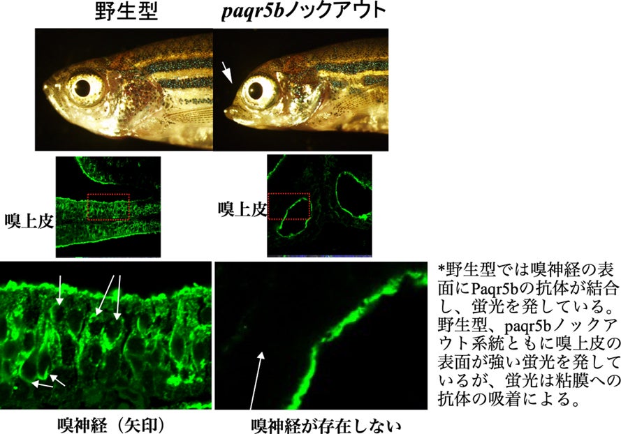 17-OH プロゲステロン検査が行われる理由
