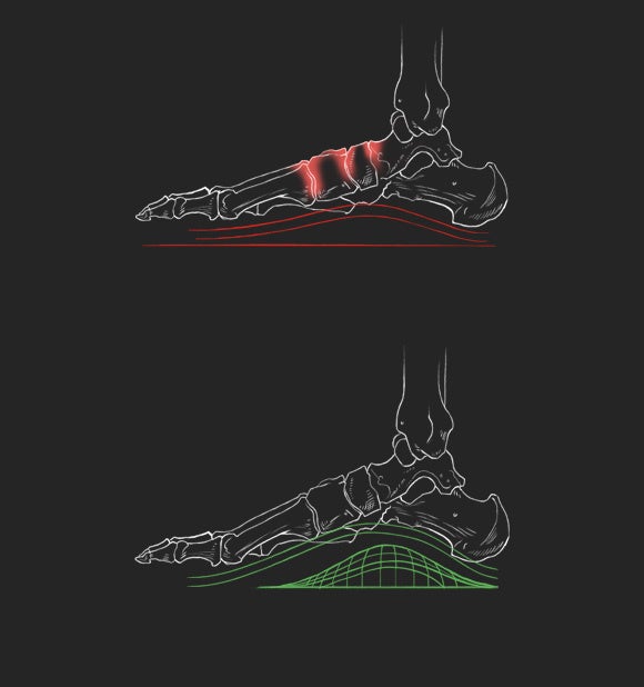 （上）縦足弓アーチなし（下）Body Geometry縦足弓アーチあり