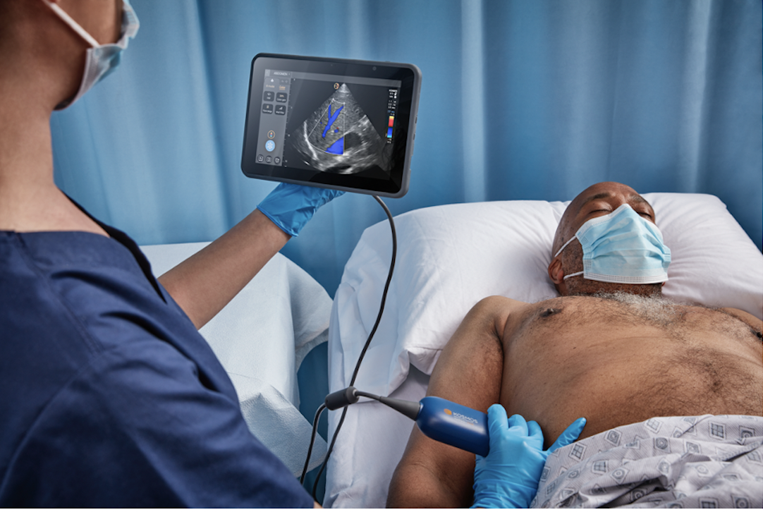 米・超音波メーカーのエコノス、AI技術を活用して開発した、CW・PW